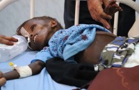 &amp;#39;Net God kan ons red&amp;#39;: Jemenitiese kinders ly honger as hulp by die grens gehou word